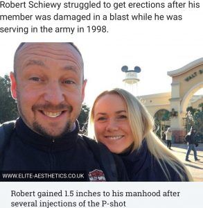 P Shot before and after pictures