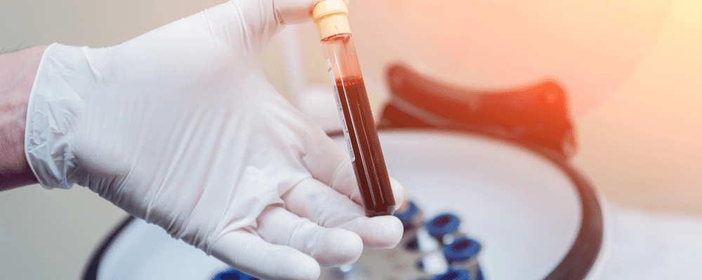 best lubricant for lichen sclerosus Lichen Sclerosus